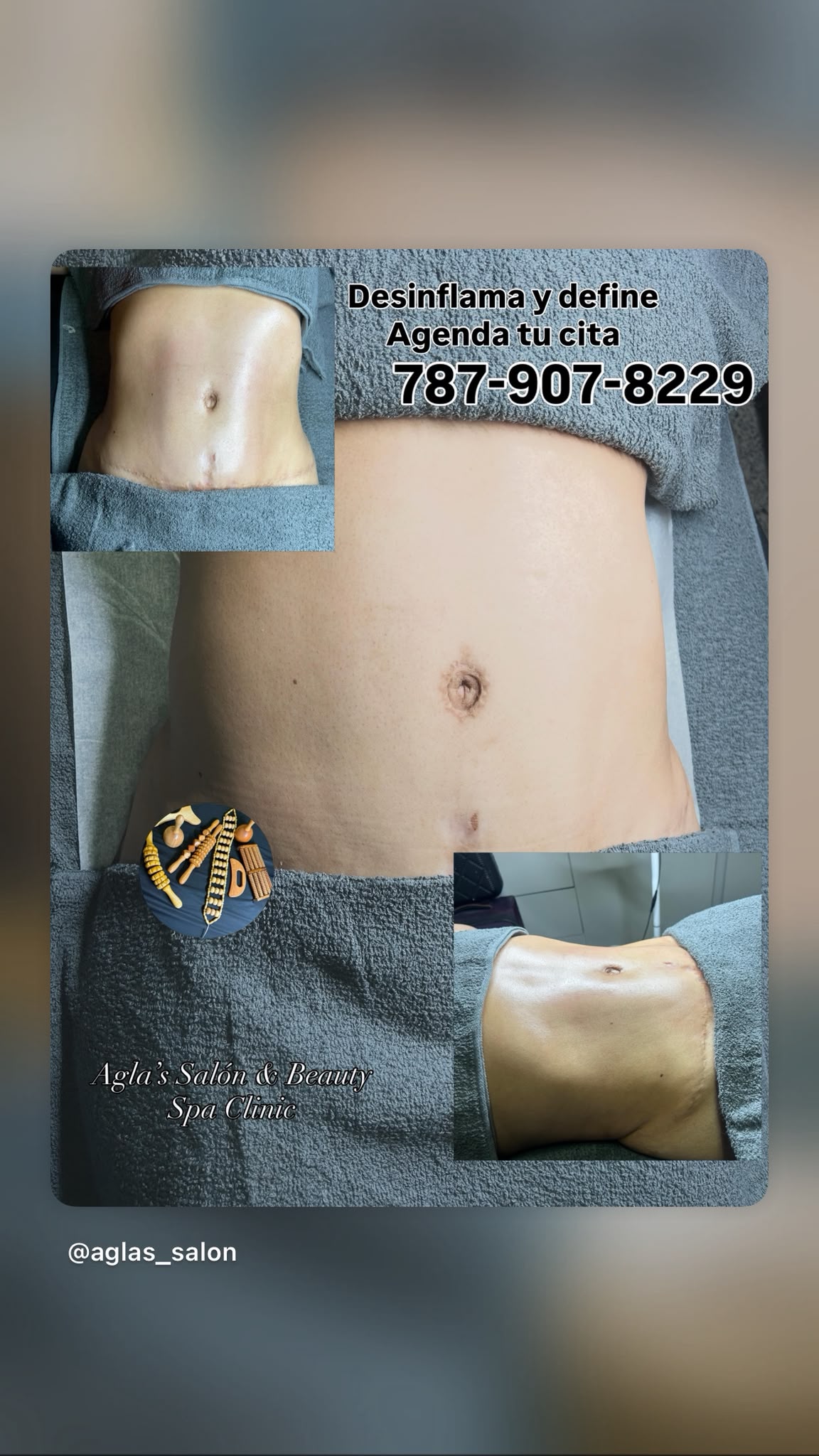 Servicio realizado en AGLA'S